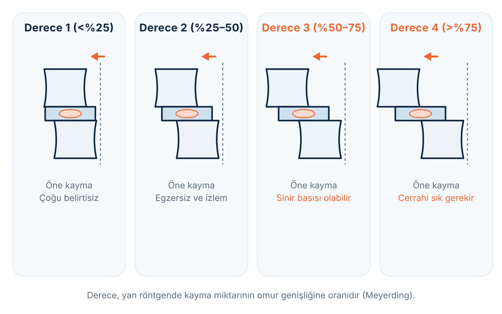 Bel kayması (spondilolistezis) dereceleri: üst omurun alttakine göre öne kayma oranı